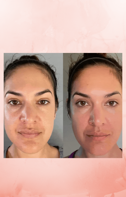 Masseur Visage Anti-Âge